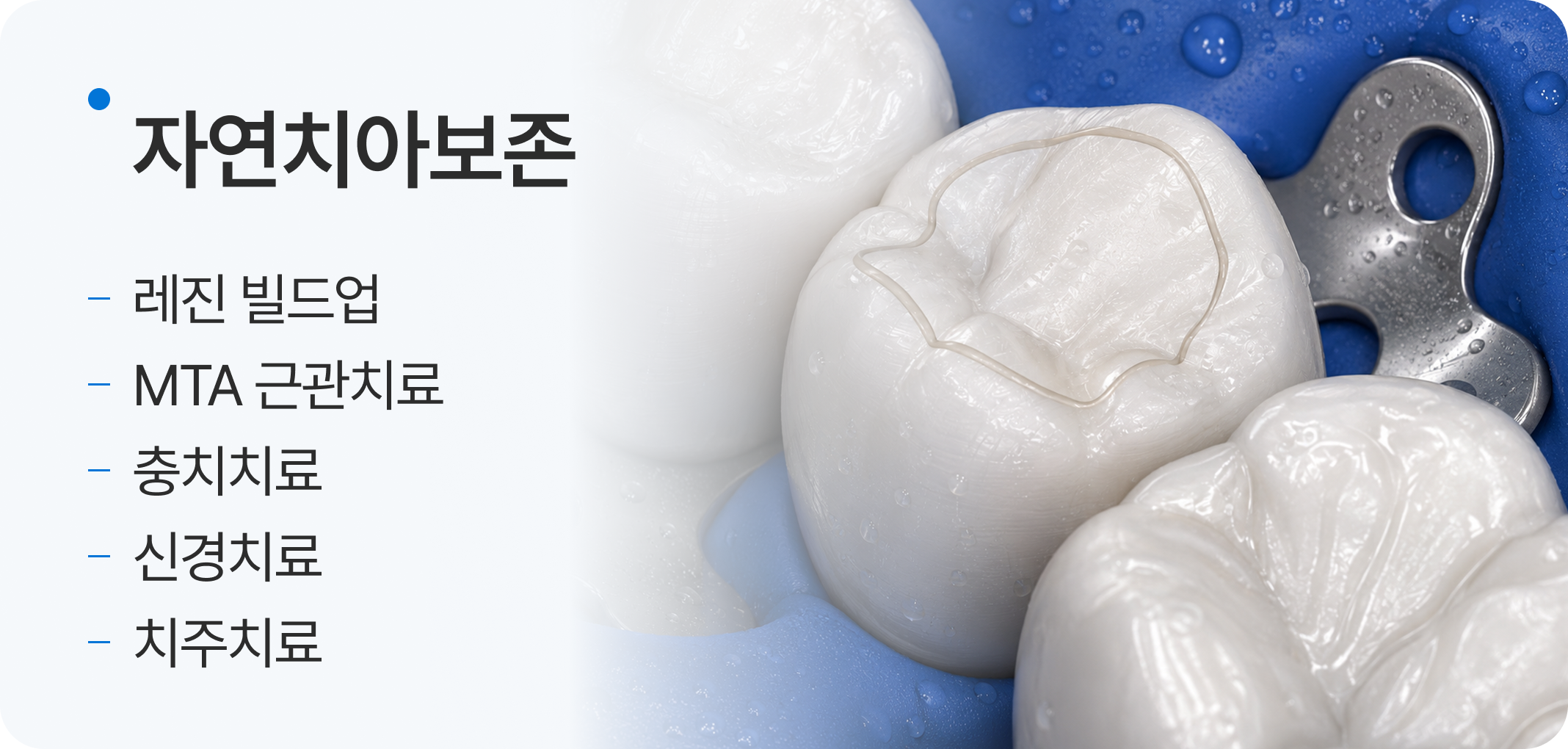 자연치아보존, 레진 빌드업, MTA 근관치료, 충치치료, 신경치료, 치주치료 