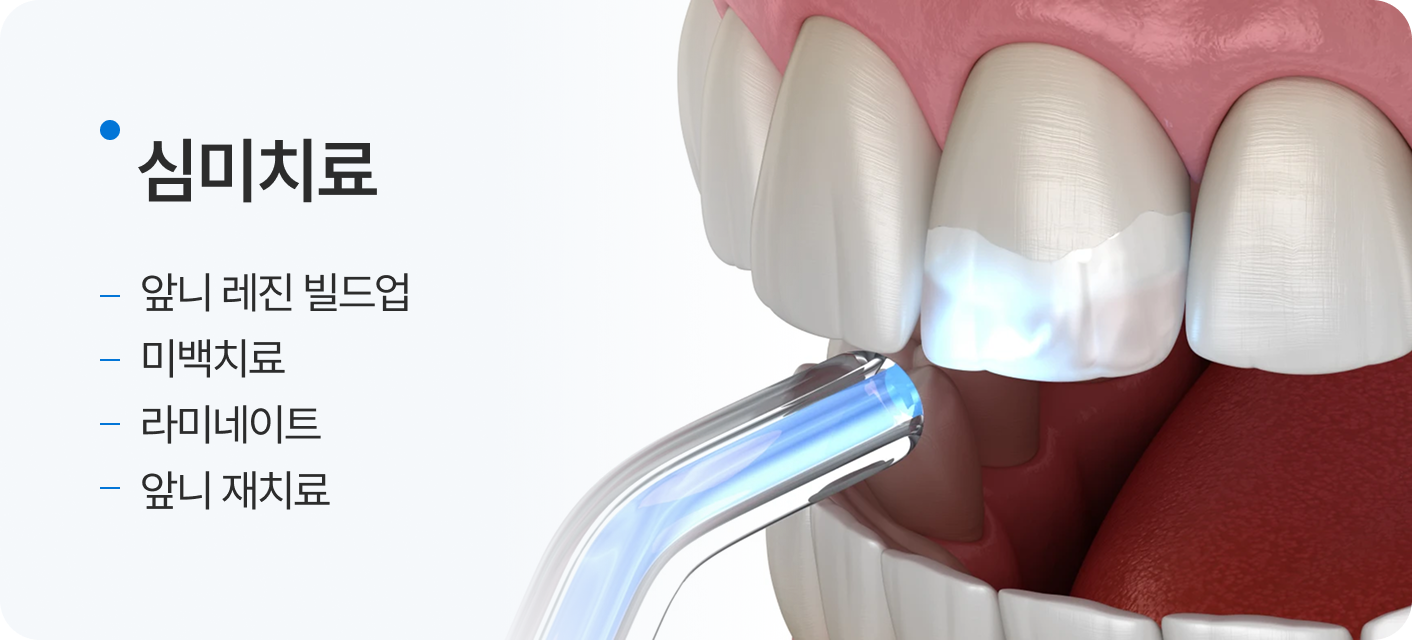 심미치료, 앞니 레진 빌드업, 미백치료, 라미네이트, 앞니 재치료