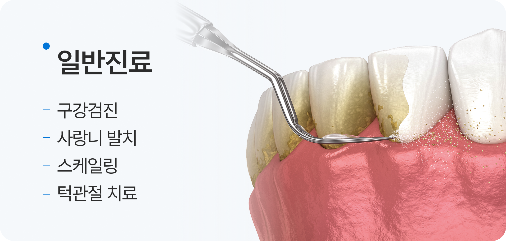 틀니진료, 전체 틀니, 부분 틀니